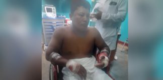 Foto: Ciudadano hospitalizado tras brutal ataque con machete en Rivas/TN8