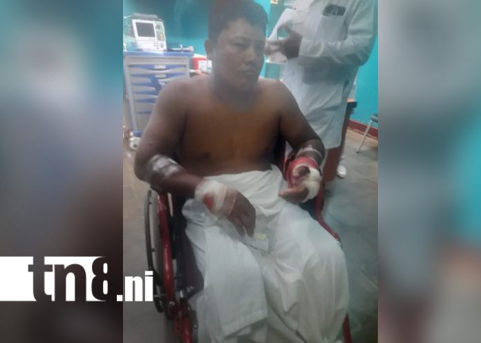 Foto: Ciudadano hospitalizado tras brutal ataque con machete en Rivas/TN8