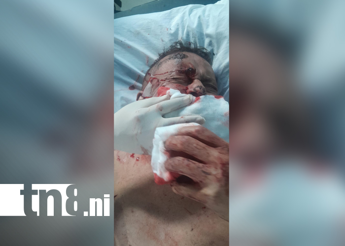 Foto: Violento ataque en Linda Vista deja a un hombre gravemente herido/TN8