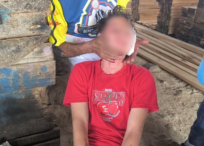 Foto: Policía investiga violenta riña en sector de Estelí / TN8