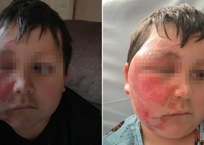 Foto: Reto viral en Estados Unidos provoca grave accidente /cortesía