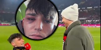 agreden al árbitro que se comprometió en pleno estadio