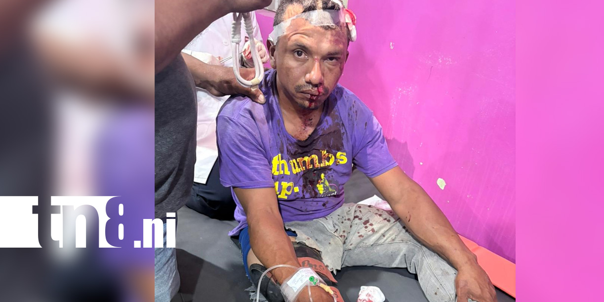Foto. Accidente de tránsito deja dos lesionados y cuantiosos daños en carretera/TN8