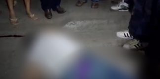 Foto: Peatón lesionado en Estelí tras ser atropellado por motociclistas que se dieron a la fuga/TN8