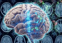 Terapia contra el cáncer muestra eficacia prometedora contra el Alzheimer Foto: Terapias contra el Alzheimer/cortesía