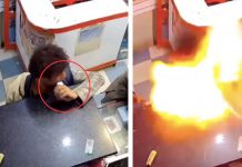 Terror en India: mordió batería de su celular y le explotó en la cara Foto: Incidente en India: batería de celular estalla luego de ser mordida /Cortesía