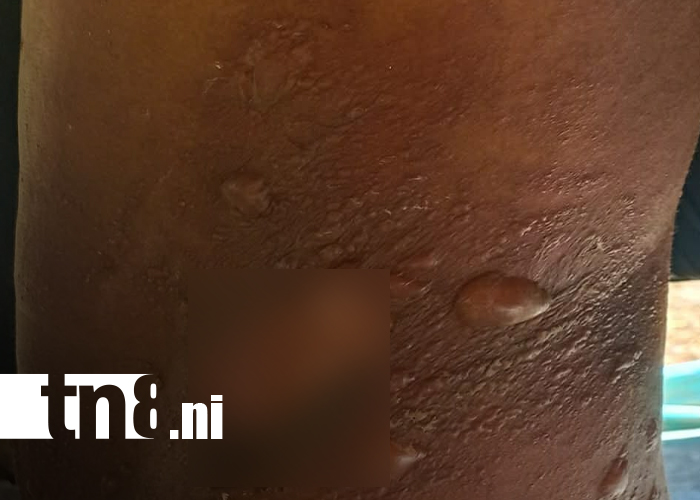 Foto: Minería artesanal vuelve a cobrar víctimas en Río San Juan / TN8