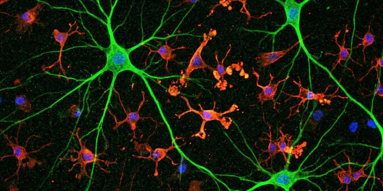 Foto: Envejecimiento del cerebro: crean atlas que revela cambios/Cortesía