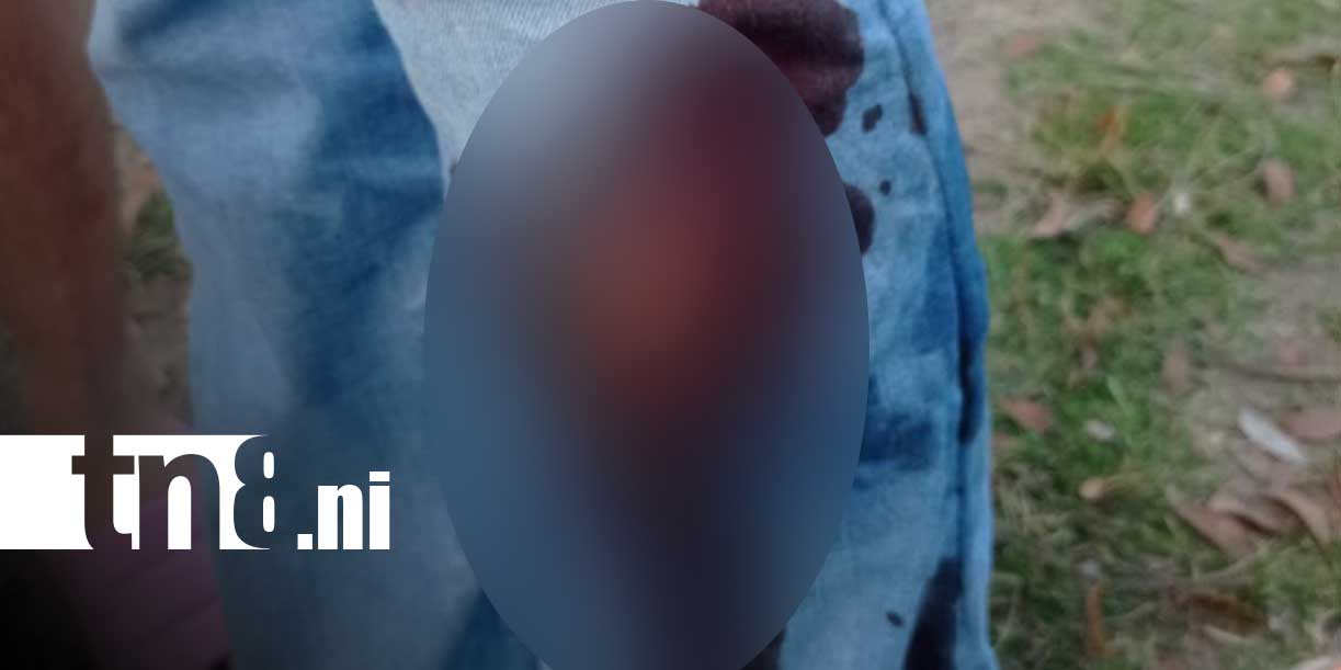 Foto: Terror en Dipilto: jauría de perros ataca a joven/TN8