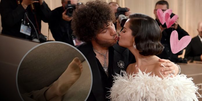 Foto: Benny Blanco y la polémica sobre sus pies /cortesía