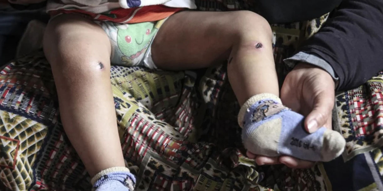 Foto: Fuerzas de Israel agreden a un bebé de 18 meses/Cortesía