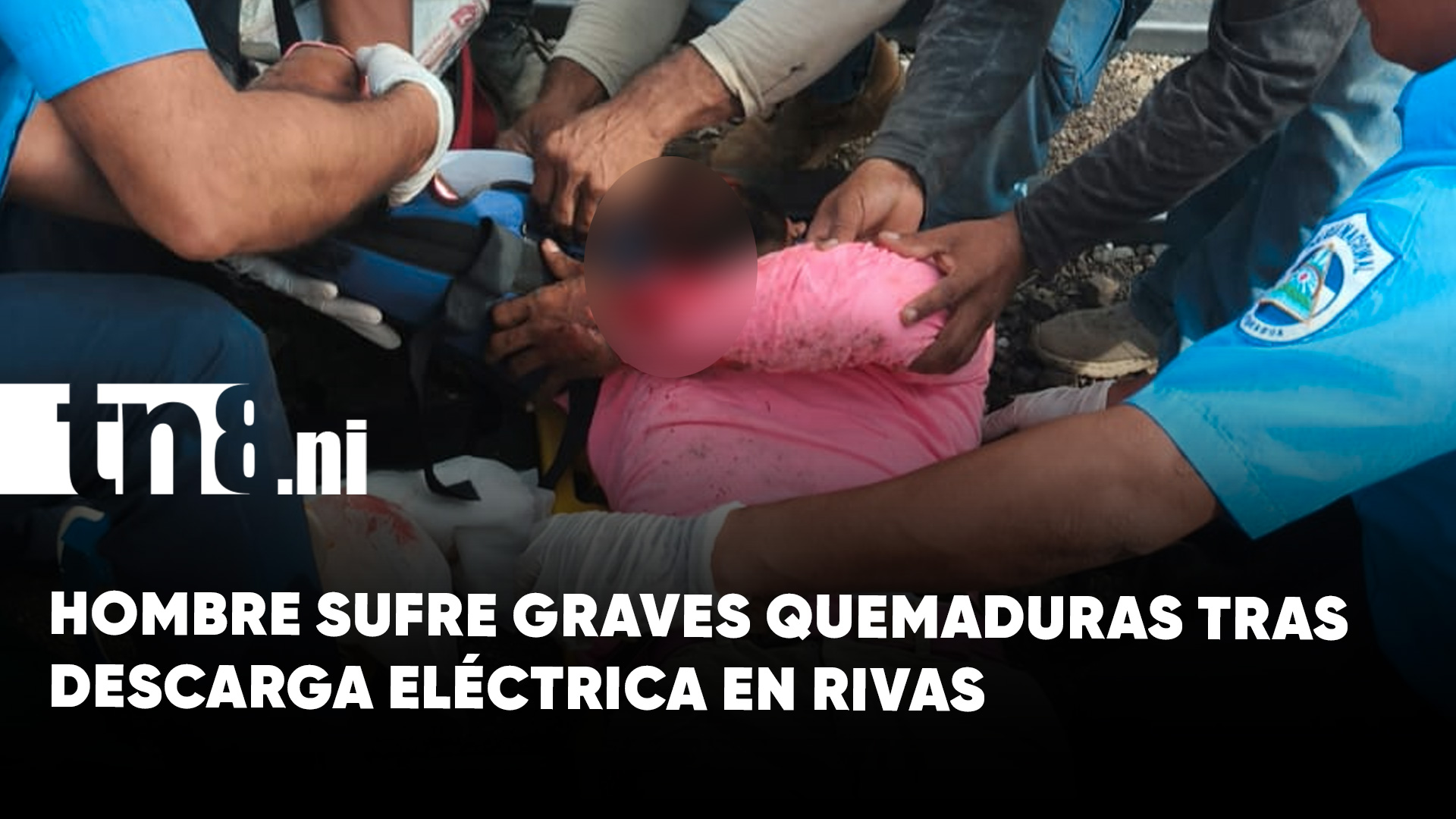Hombre sufre graves quemaduras tras recibir fuerte descarga eléctrica ...
