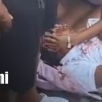 Foto: Chinandega: estudiante gravemente lesionado tras ataque/TN8