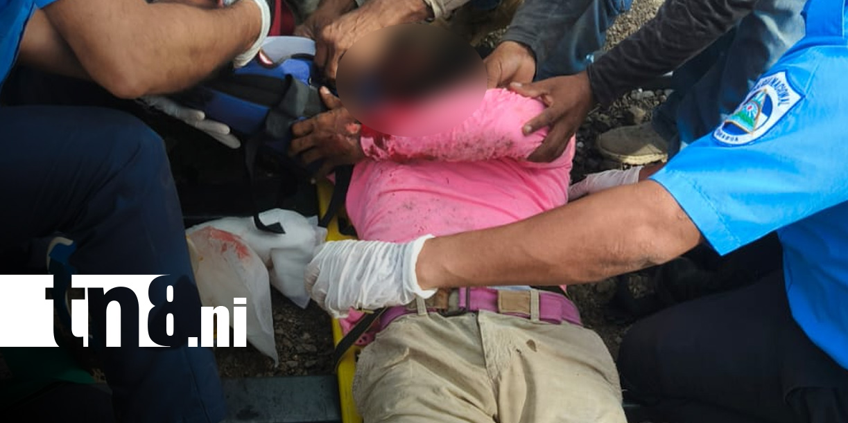 Foto: Rivas: Hombre sufre graves quemaduras/ TN8