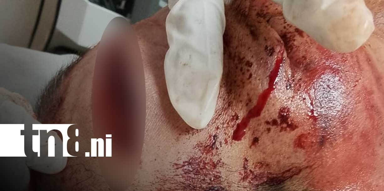 Foto: Machetazos en San Juan del Sur, Rivas dejan un fallecido/TN8