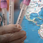 Foto: Alerta por hantavirus /cortesía