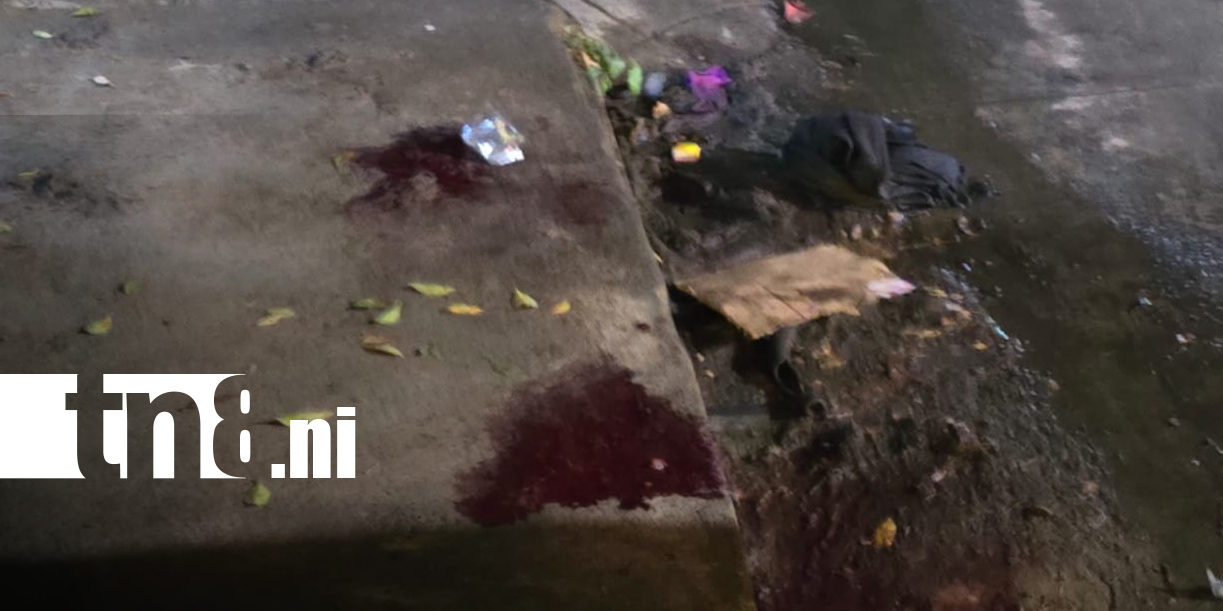 Foto: Accidente en Managua deja motociclista gravemente herido/TN8