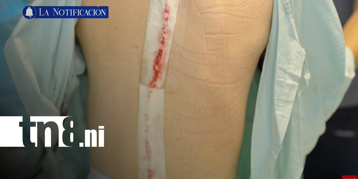 Foto: El caso médico más impactante de Nicaragua: la recuperación milograsa de Carlos Arana/TN8