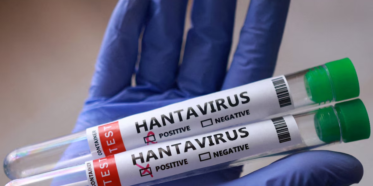 Foto: Argentina confirma 45 casos de hantavirus /Cortesía