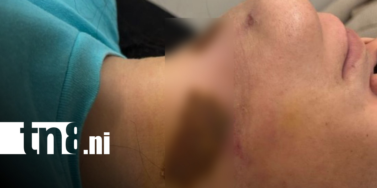 Foto: Víctima denuncia quemaduras tras cirugía de lipopapada en Managua / TN8