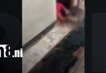 Foto: Pitbull ataca a una mujer que cuidaba a un adulto mayor en Matagalpa/TN8