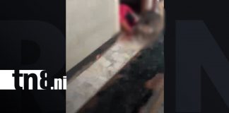 Foto: Pitbull ataca a una mujer que cuidaba a un adulto mayor en Matagalpa/TN8
