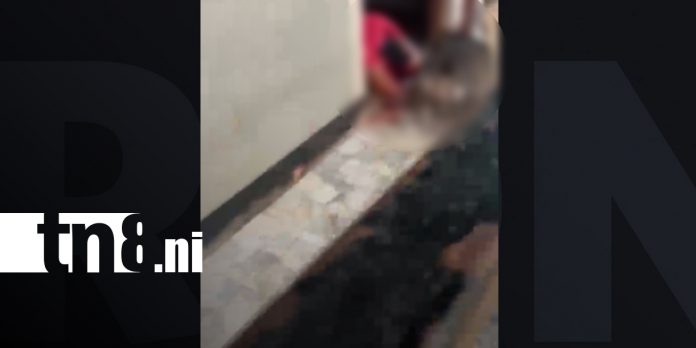 1 Foto: Pitbull ataca a una mujer que cuidaba a un adulto mayor en Matagalpa/TN8