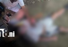 Peatón resulta lesionado tras ser atropellado por motocicleta en Estelí Foto: Peatón resulta lesionado tras ser atropellado por motocicleta en Estelí/TN8