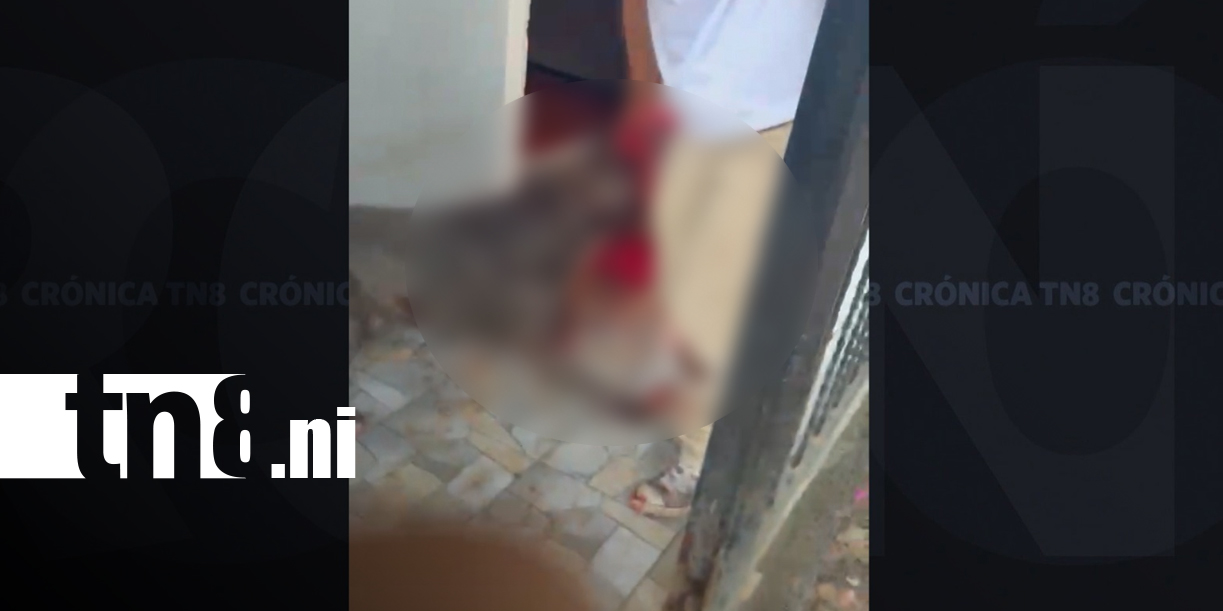 Foto: Pitbull ataca a una mujer que cuidaba a un adulto mayor en Matagalpa/TN8