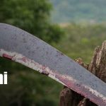 ¡Por poco lo matan a machetazos! tres hombres enfrentan juicio en Managua Foto: ¡Por poco lo matan! Juicio por brutal ataque en Managua / TN8