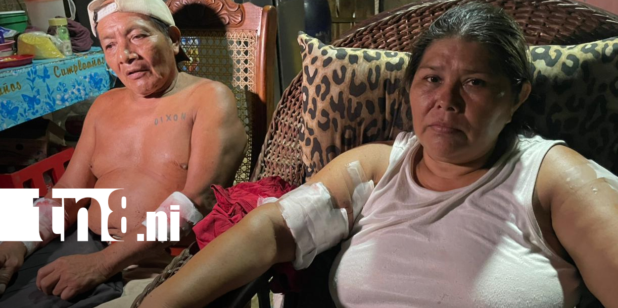 Foto: Pitbull ataca a niña de un año y deja heridos a sus abuelos/TN8