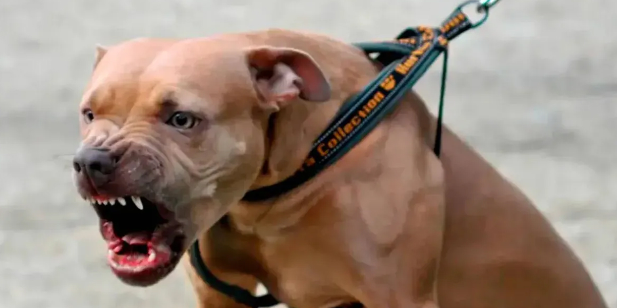 Foto: Pitbull ataca a niño de 7 años en Ometepe /TN8