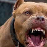 Foto: Otro ataque de pitbull: esta vez un menor de 12 años resulta herido en Masaya /Cortesía