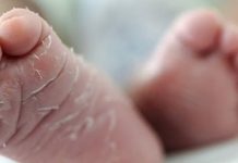 Foto: Gemelas de 15 meses mueren por presunta deshidratación en Francia /Cortesía