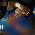 Foto: Accidente en Waspan Sur, Managua, deja motociclista lesionado/TN8