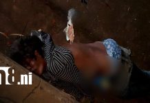 Mujer resulta gravemente lesionada tras ser atropellada por un taxi en la carretera Tipitapa–Masaya Foto: Mujer gravemente lesionada tras ser atropellada/TN8
