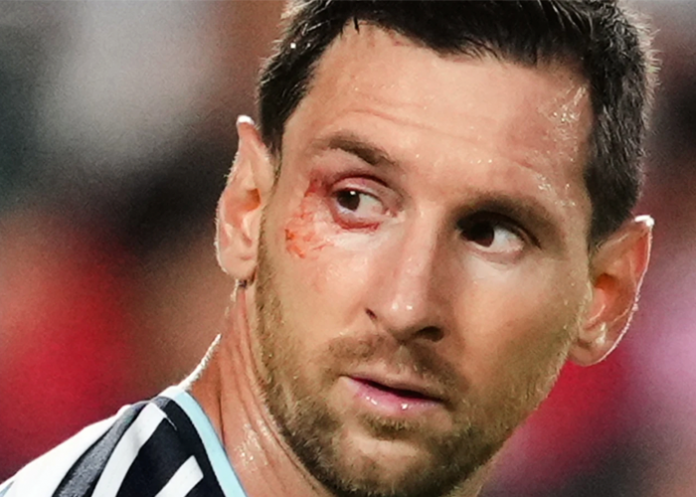 Lionel Messi acabó su racha goleadora en el mundial