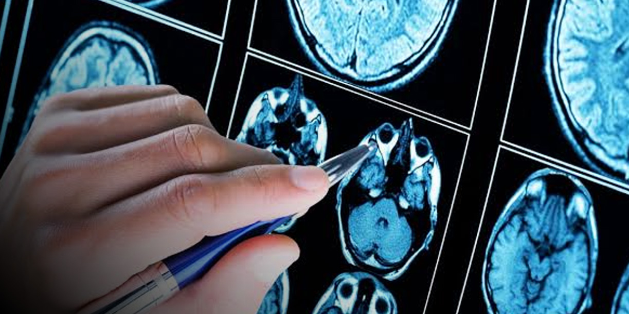 Foto: La práctica médica de la neurocirugía