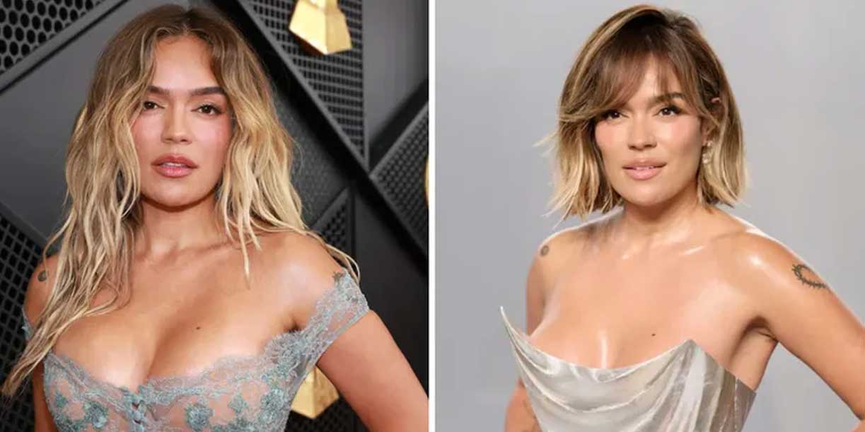Foto: Karol G revela el impacto físico de su gira: “Para el cuerpo es difícil” / Cortesía