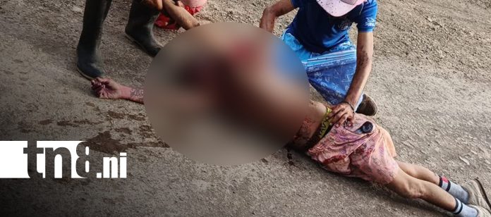 Foto: Joven resulta herido tras incidente en Juigalpa, Chontales/TN8 Foto: Joven resulta herido tras incidente en Juigalpa, Chontales/TN8