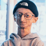 Michiel Vandeweert muere a los 28 años tras desafiar la progeria Foto: Muere a los 28 años Michiel Vandeweert /Cortesía