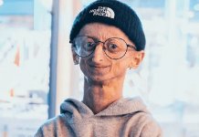 Michiel Vandeweert muere a los 28 años tras desafiar la progeria Foto: Muere a los 28 años Michiel Vandeweert /Cortesía