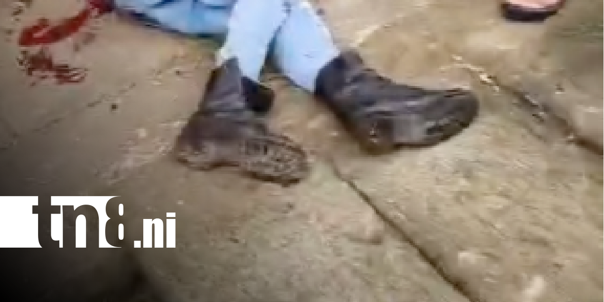 Foto: Ataque con machete en un barrio de Managua / TN8