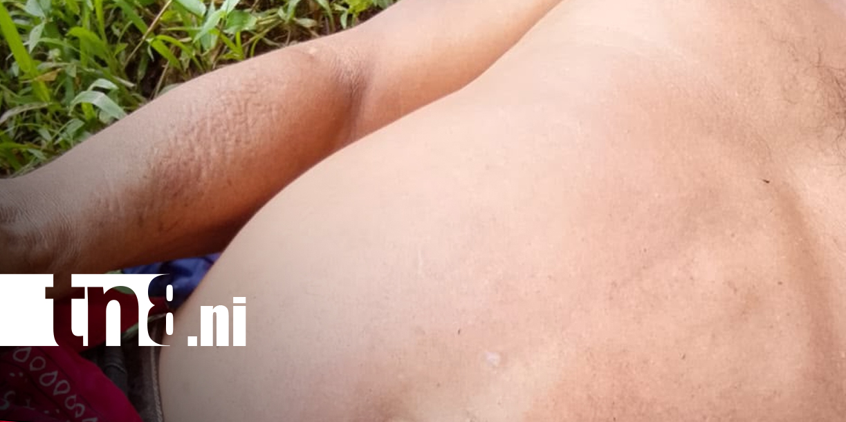 Foto: Ataque de encapuchados deja heridos en Yakalwás, Wiwilí, Jinotega/TN8