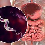 Foto: Campylobacter preocupa por su resistencia/Cortesía
