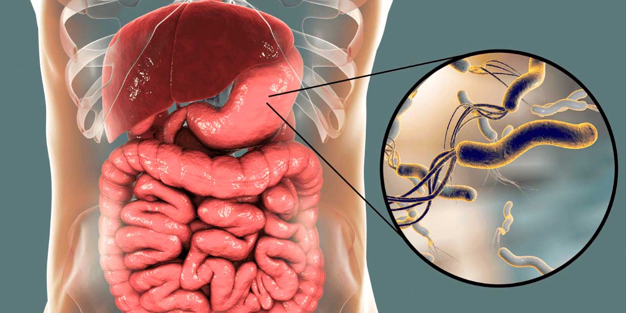 Foto: Helicobacter pylori enciende alerta científica/Cortesía