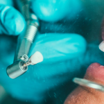 Placa bacteriana vs. sarro: descubre sus diferencias y cómo prevenirlos Foto: ¿Placa o sarro? Conoce la diferencia y cómo prevenirlos/Cortesía