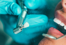 Placa bacteriana vs. sarro: descubre sus diferencias y cómo prevenirlos Foto: ¿Placa o sarro? Conoce la diferencia y cómo prevenirlos/Cortesía