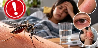 Foto: ¿Fiebre y dolor? Así se diferencian el dengue, chikungunya y Zika /Cortesía