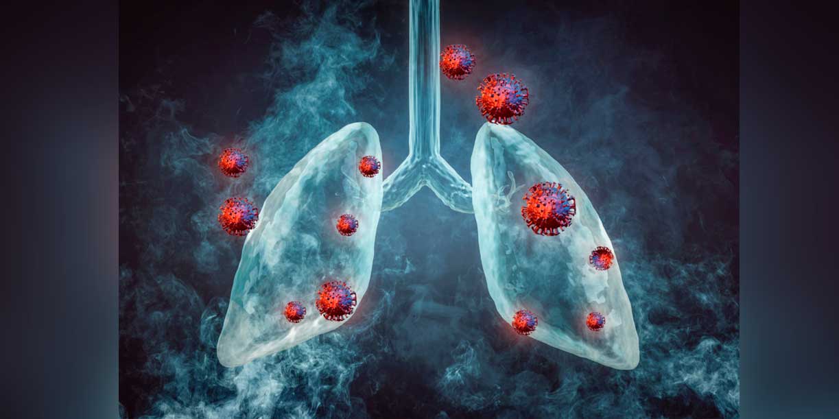 Foto: Nuevo estudio sobre cáncer de pulmón destaca resultados/Cortesía